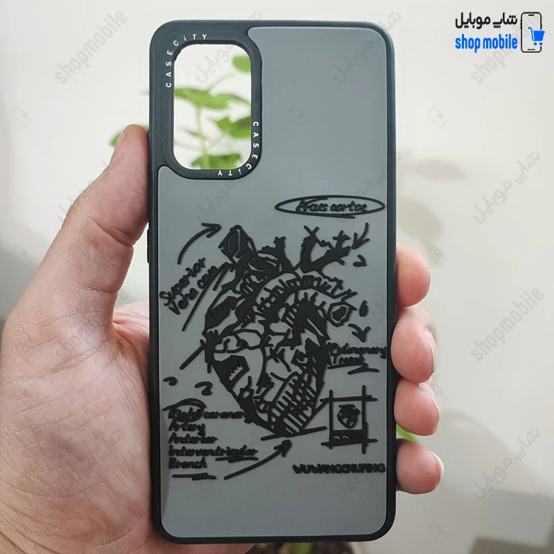قاب گوشی سامسونگ گلکسی A32 4G (کاور Case City طرح آناتومی قلب برجسته)