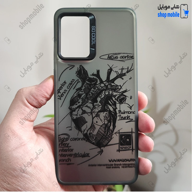 قاب گوشی سامسونگ گلکسی A06 (کاور فانتزی So Cool طرح آناتومی قلب)