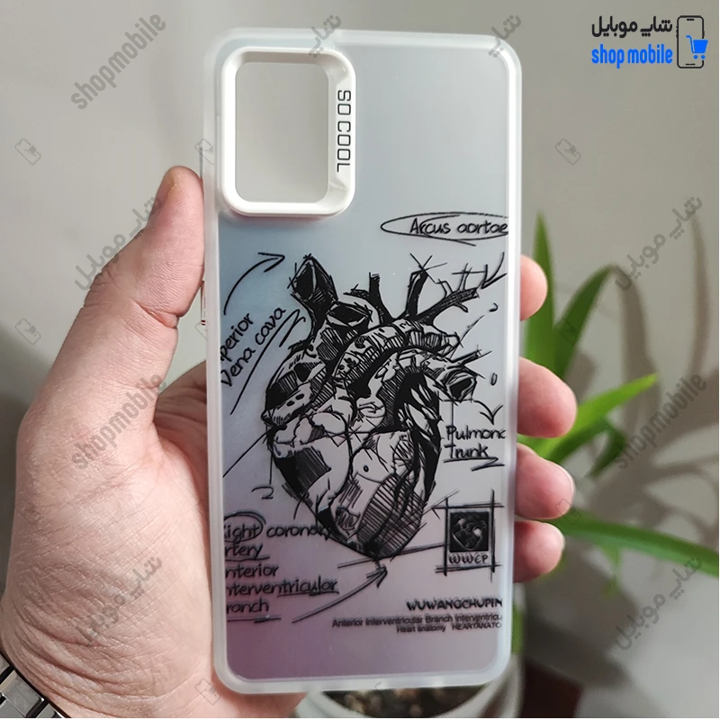 قاب گوشی سامسونگ گلکسی A05 (کاور فانتزی So Cool طرح آناتومی قلب Silver)
