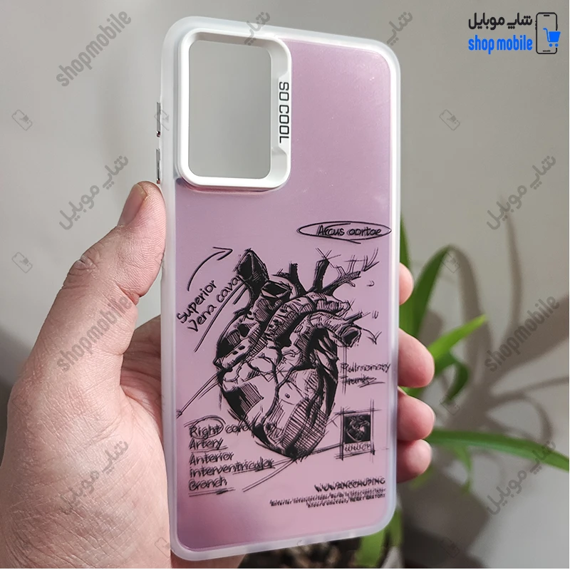 قاب گوشی سامسونگ گلکسی A52 / A52S (کاور فانتزی So Cool طرح آناتومی قلب رنگ یاسی)