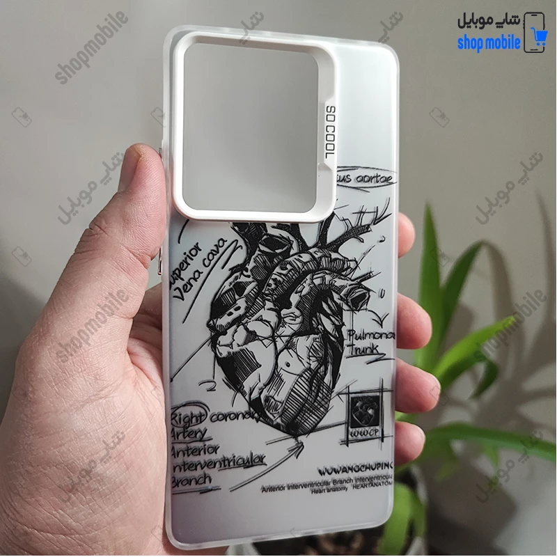 قاب گوشی شیائومی ردمی نوت 14 5G (کاور فانتزی So Cool طرح آناتومی قلب Silver)