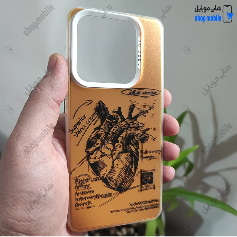 قاب گوشی شیائومی ردمی نوت 14 5G (کاور فانتزی So Cool طرح آناتومی قلب رنگ طلایی)