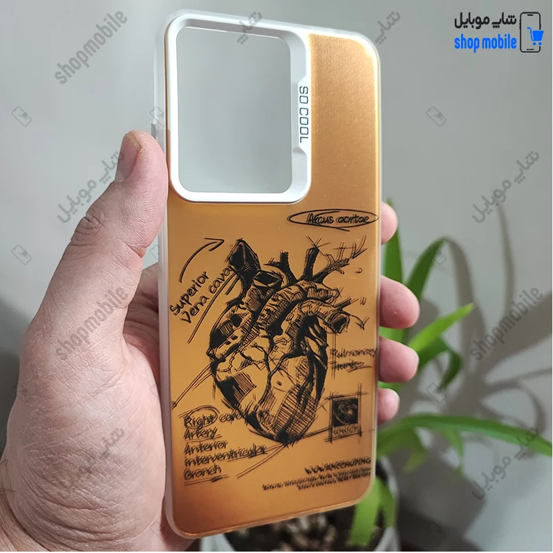 قاب گوشی شیائومی ردمی نوت 14S نوت 13 پرو 4G پوکو M6 پرو 4G (کاور فانتزی So Cool طرح آناتومی قلب رنگ طلایی)