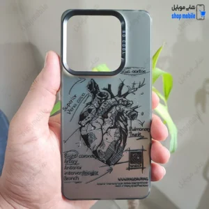 قاب گوشی شیائومی ردمی نوت 13 4G (کاور فانتزی So Cool طرح آناتومی قلب)