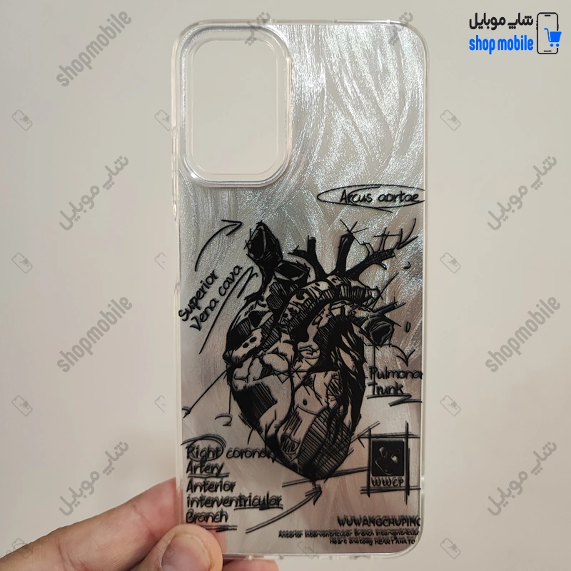 قاب گوشی سامسونگ گلکسی A05 (کاور IMD براش طرح آناتومی قلب Silver)
