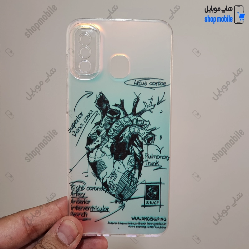قاب گوشی سامسونگ گلکسی A20 - A30 (کاور هولوگرامی فانتزی طرح آناتومی قلب Silver)