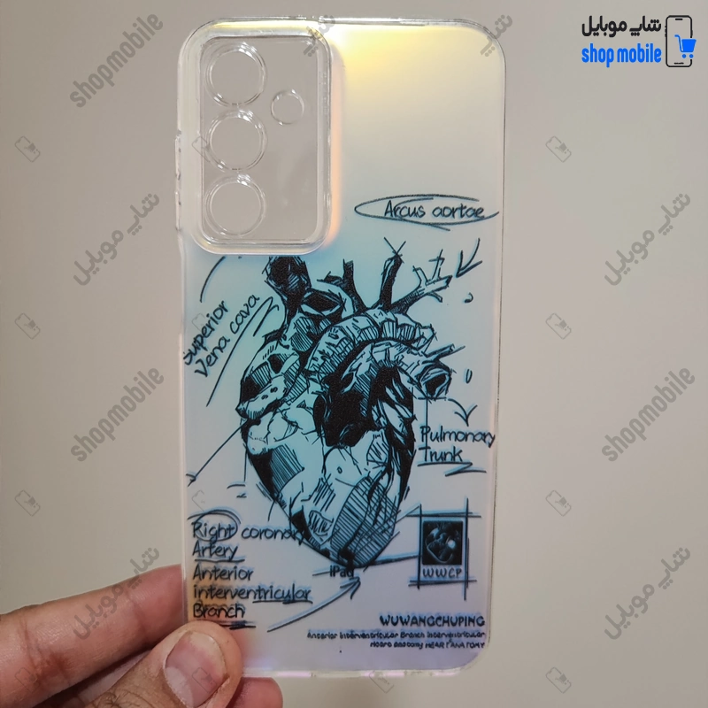 قاب گوشی سامسونگ گلکسی A25 (کاور هولوگرامی فانتزی طرح آناتومی قلب Silver)