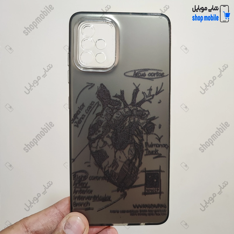 قاب گوشی سامسونگ گلکسی A51 (کاور فانتزی IMD طرح آناتومی قلب)