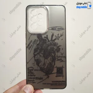 قاب گوشی سامسونگ گلکسی A53 (کاور فانتزی IMD طرح آناتومی قلب)