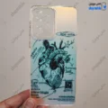 قاب گوشی سامسونگ گلکسی A53 (کاور هولوگرامی فانتزی طرح آناتومی قلب Silver)
