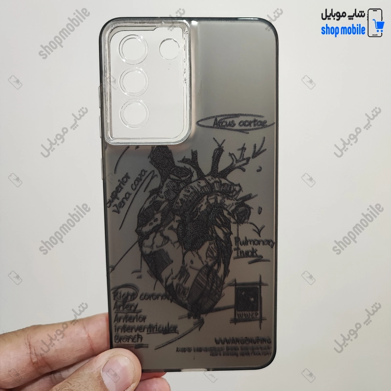 قاب گوشی سامسونگ گلکسی S21 FE (کاور فانتزی IMD طرح آناتومی قلب)