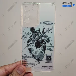 قاب گوشی سامسونگ گلکسی S21 FE (کاور هولوگرامی فانتزی طرح آناتومی قلب Silver)