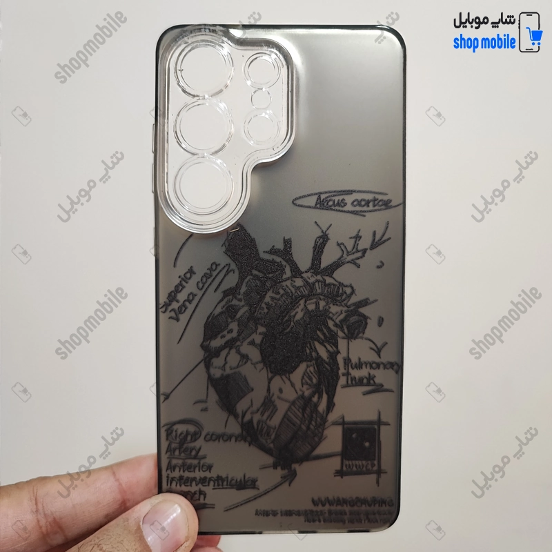 قاب گوشی سامسونگ گلکسی S26 اولترا (کاور فانتزی IMD طرح آناتومی قلب)