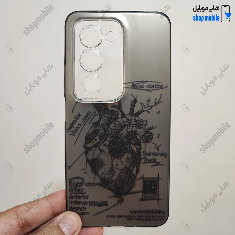 قاب گوشی شیائومی ردمی 15 (کاور فانتزی IMD طرح آناتومی قلب)