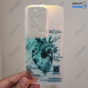 قاب گوشی شیائومی ردمی 15 (کاور هولوگرامی فانتزی طرح آناتومی قلب Silver)