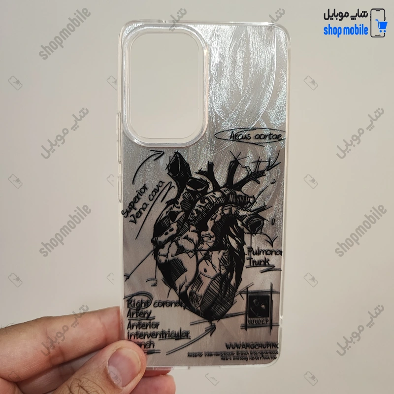 قاب گوشی شیائومی ردمی نوت 10 پرو - نوت 10 پرو مکس (کاور IMD براش طرح آناتومی قلب Silver)