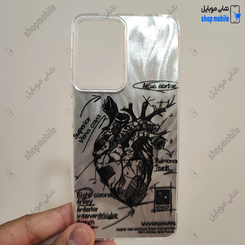 قاب گوشی شیائومی ردمی نوت 11 پرو پلاس (کاور IMD براش طرح آناتومی قلب Silver)