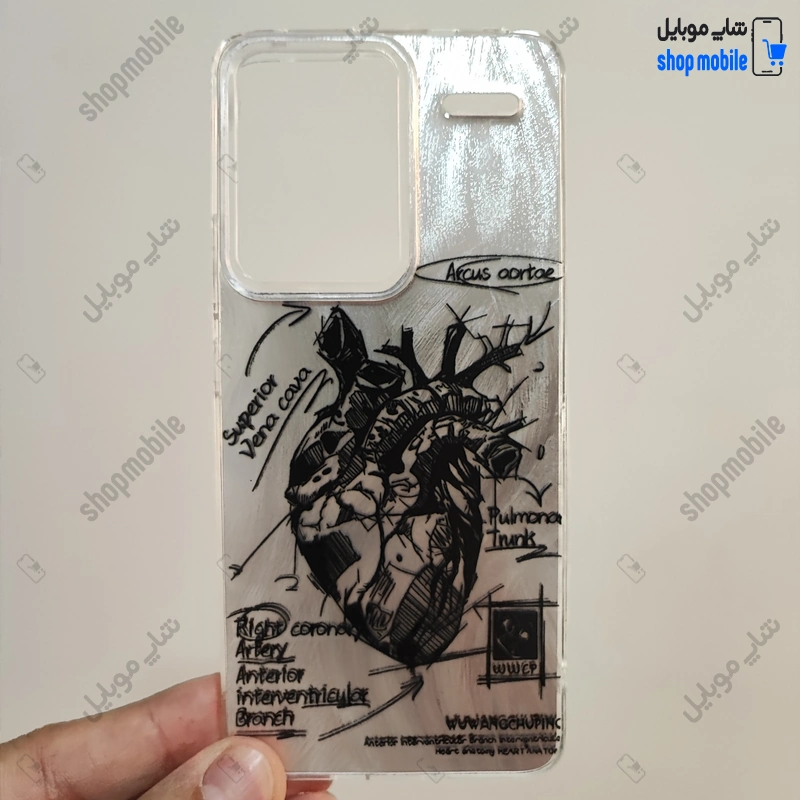 قاب گوشی شیائومی ردمی نوت 13 پرو پلاس 5G (کاور IMD براش طرح آناتومی قلب Silver)