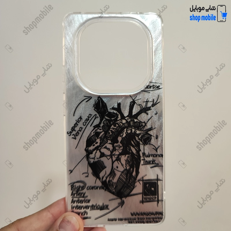 قاب گوشی شیائومی ردمی نوت 14 پرو 4G (کاور IMD براش طرح آناتومی قلب Silver)