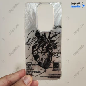 قاب گوشی شیائومی ردمی نوت 8 پرو (کاور IMD براش طرح آناتومی قلب Silver)